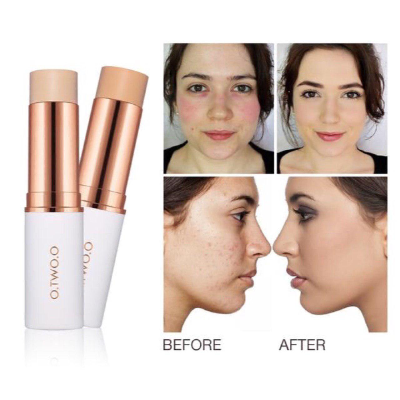 Magical Concealer® for All Skin Tones